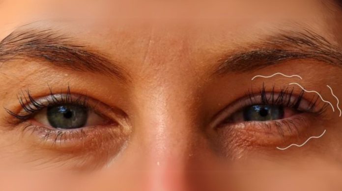 Why Do My Eyes Keep Twitching? The Shocking Causes You Never Considered