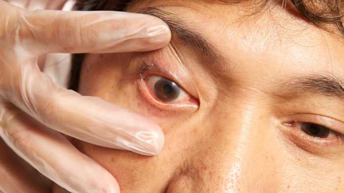 7 Common Eye Symptoms You Shouldn’t Ignore in 2025