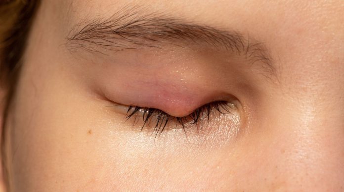What is the most dangerous eye disease?
