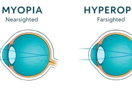 Myopia & Hyperopia Explained: Causes, Symptoms & Treatments Myopia & Hyperopia Explained