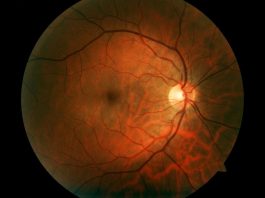 Stargardt Disease Causes, Symptoms & Latest Treatments