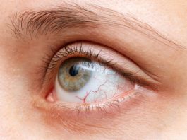 Why Your Eyes Feel Tired Even After a Full Night's Sleep