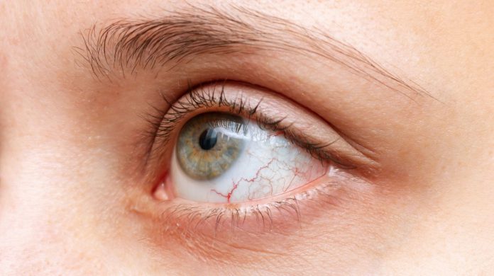Why Your Eyes Feel Tired Even After a Full Night's Sleep