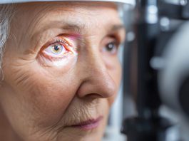 Cataract Lens Replacement Failure What Can You Do About It