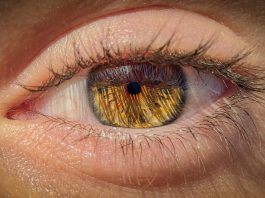 Meibomian Gland Dysfunction